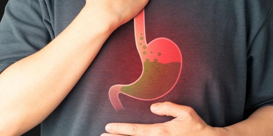علاج ارتجاع المريء بدون أدوية.. خطوات لتخفيف الأعراض