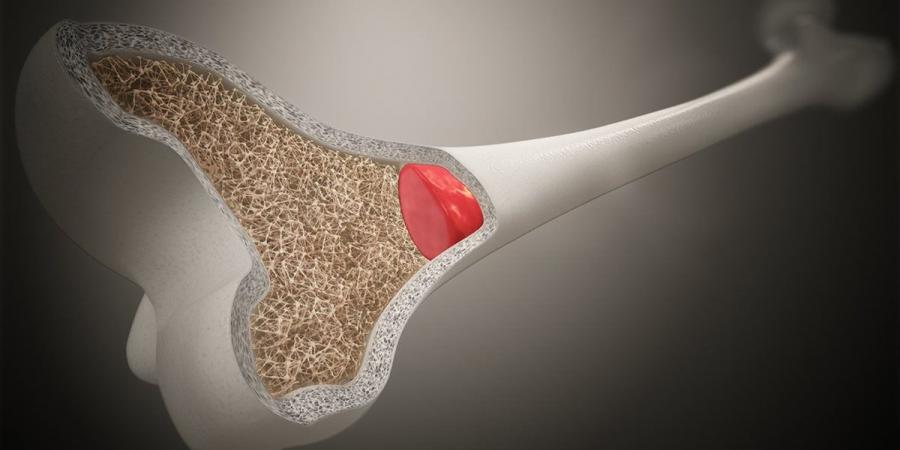 فوائد نخاع العظام.. عنصر غذائي يدعم صحة المفاصل والمناعة