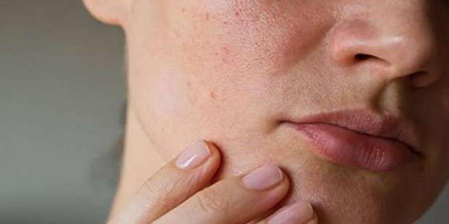 علامات الجفاف لا تقتصر على العطش.. انتبه لهذه الأعراض