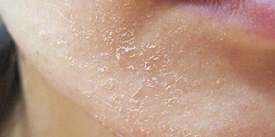 علامات تنذر بتجفاف الجسم