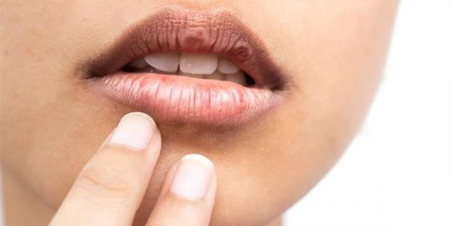 لماذا يحدث جفاف الفم عند التوتر والقلق؟