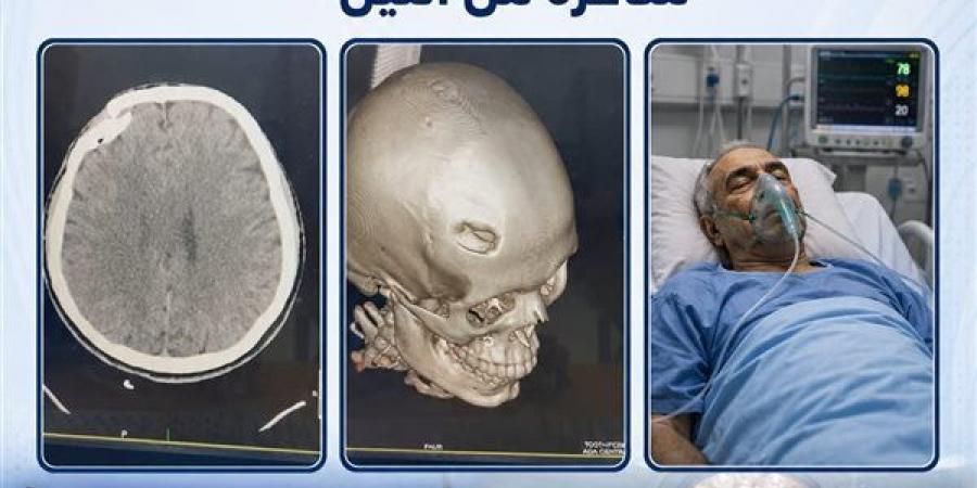 نجاح فريق مستشفى أجا بالدقهلية في إنقاذ حالتين حرجتين داخل وحدة السكتة الدماغية