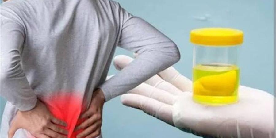 لون البول في الصباح.. ماذا يخبرك عن حالة جسمك؟