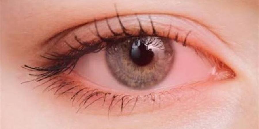 لماذا تدمع العين أثناء تناول بعض الأطعمة؟