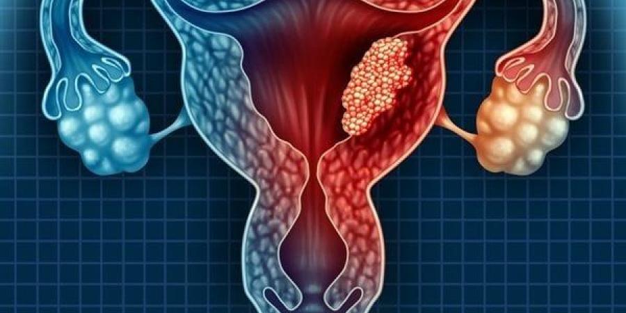 أطعمة محددة قد تساعد في الوقاية من سرطان عنق الرحم