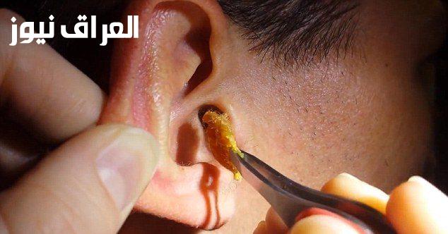 طريقة مجربة تشيل شمع الأذن