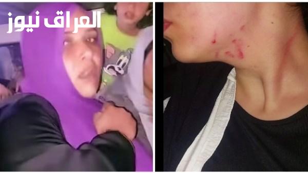 سيدة تهاجم فتاة بالضرب والعض داخل ميكروباص وتسبب تشوه وجهها