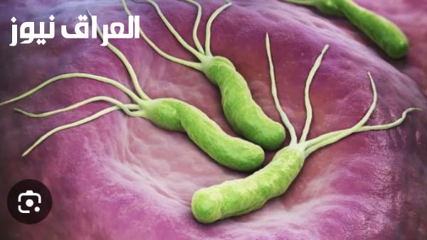 استشاري أمراض باطنة يوضح أربع طرق لتشخيص جرثومة المعدة والعلاج خلال أسبوعين