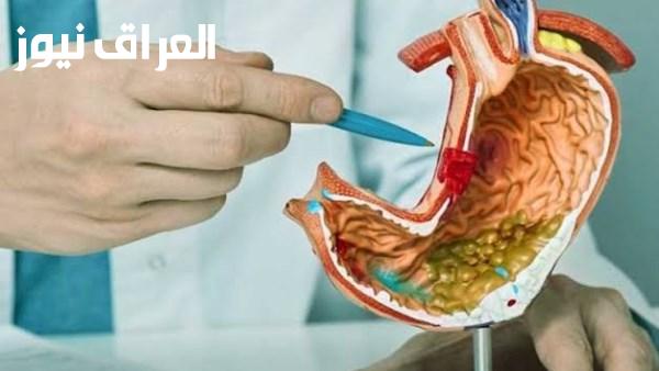 أربع طرق لتشخيص جرثومة المعدة واستشاري باطنة يكشف عن أعراضها ومخاطر إهمال العلاج