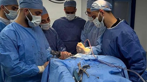 إجراء أربع عمليات جراحية متقنة للعظام في مستشفى العريش العام