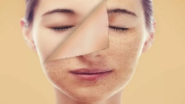علامات الوجه المرتبطة بمشكلات الكلى تشمل انتفاخ العينين وتغير لون البشرة