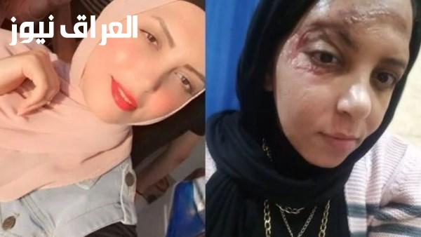 ضبط المتهم في حادث دهس فتاة برج العرب بعد عامين من فراره من حكم الحبس