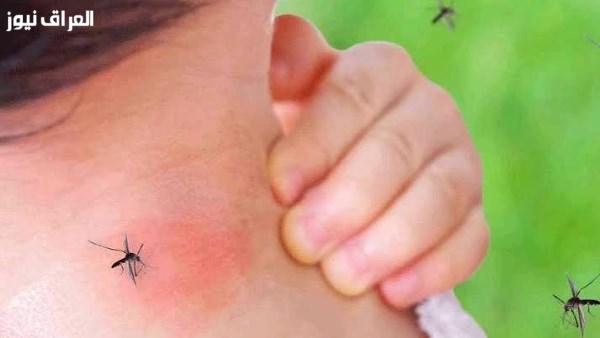 فلوريدا تعلن حالة الطوارئ الصحية بسبب تفشي قياسي لحمى الضنك