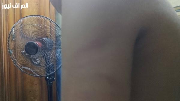 أم تطالب بحق ابنها: مُدرسة تعتدي عليه بالخرطوم وتدمر “اليونيفورم” الخاص به.. صور